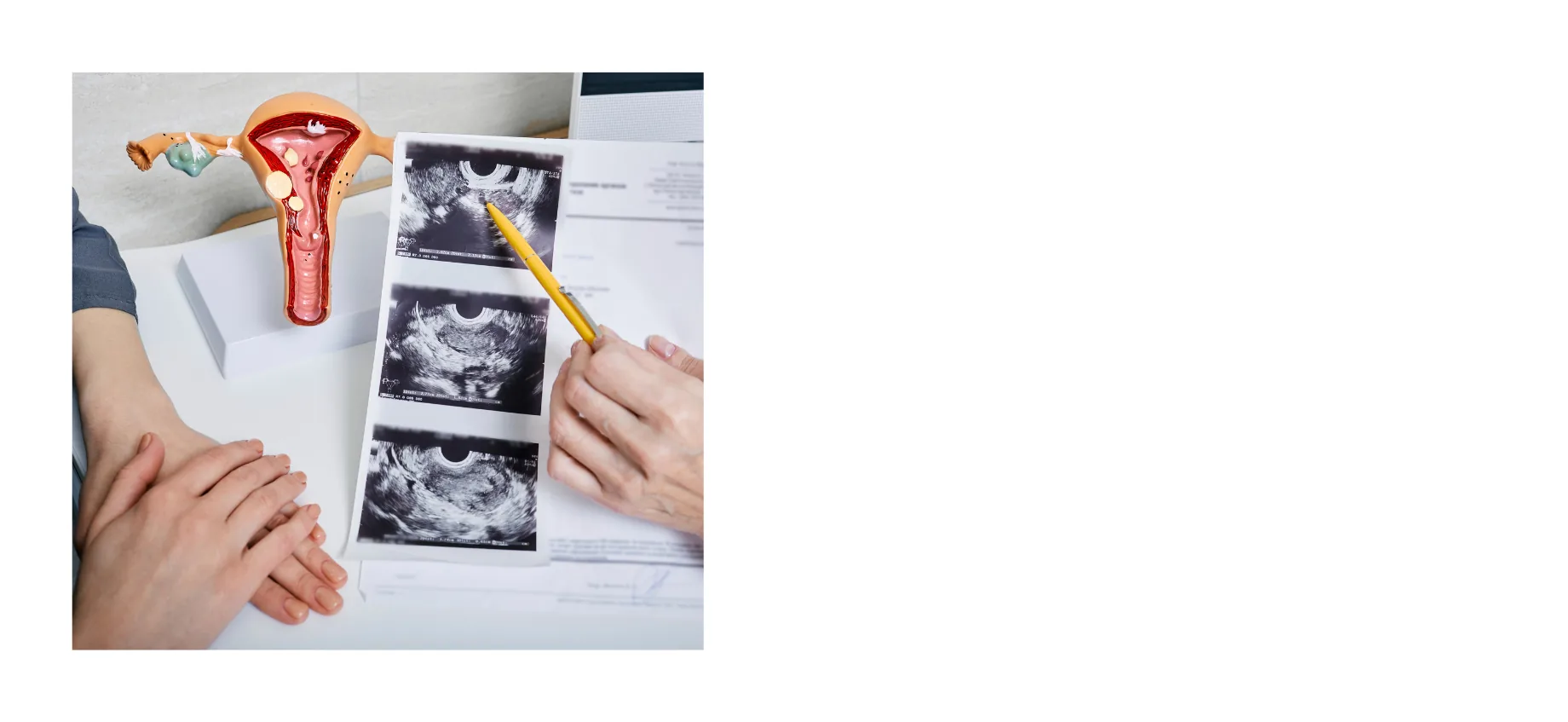 子宮の模型と経腟エコーの画像を示しながら婦人科検診の結果を説明している様子