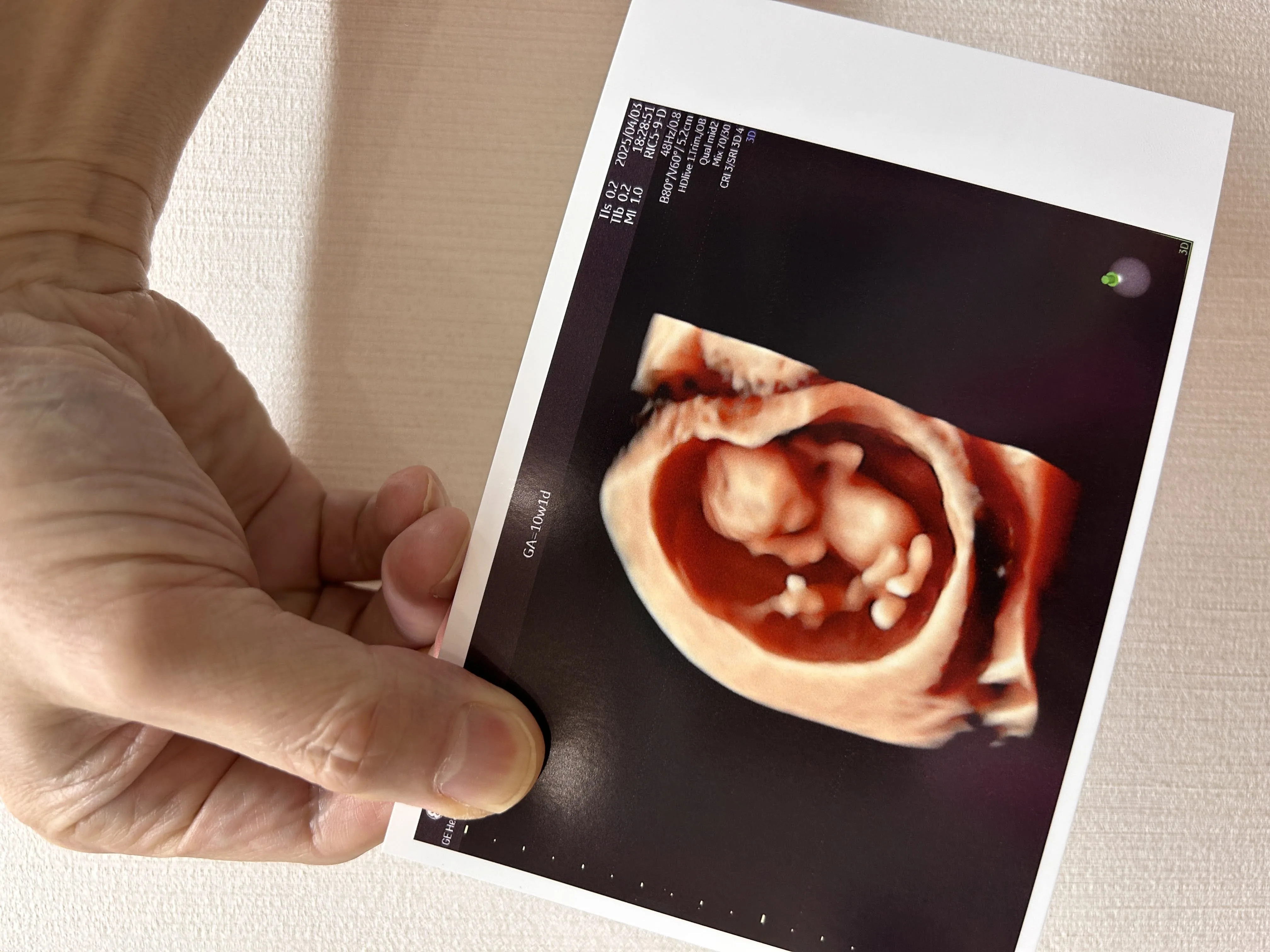 妊娠9週頃の赤ちゃんの4Dエコー写真