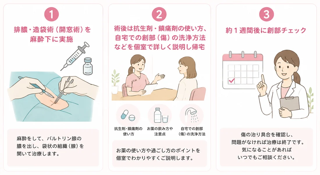 当院でのバルトリン腺膿瘍の処置と術後管理の図解。①排膿・造袋術（開窓術）を麻酔下に実施し、バルトリン腺の膿を出して袋状の組織（腺）を開いて治療する。②術後は抗生剤・鎮痛剤の使い方、お薬の飲み方や注意点、自宅での創部（傷）の洗浄方法などを個室で詳しくご説明して帰宅。③約1週間後に創部チェックを行い、傷の治り具合を確認する。問題がなければ治療は終了。
