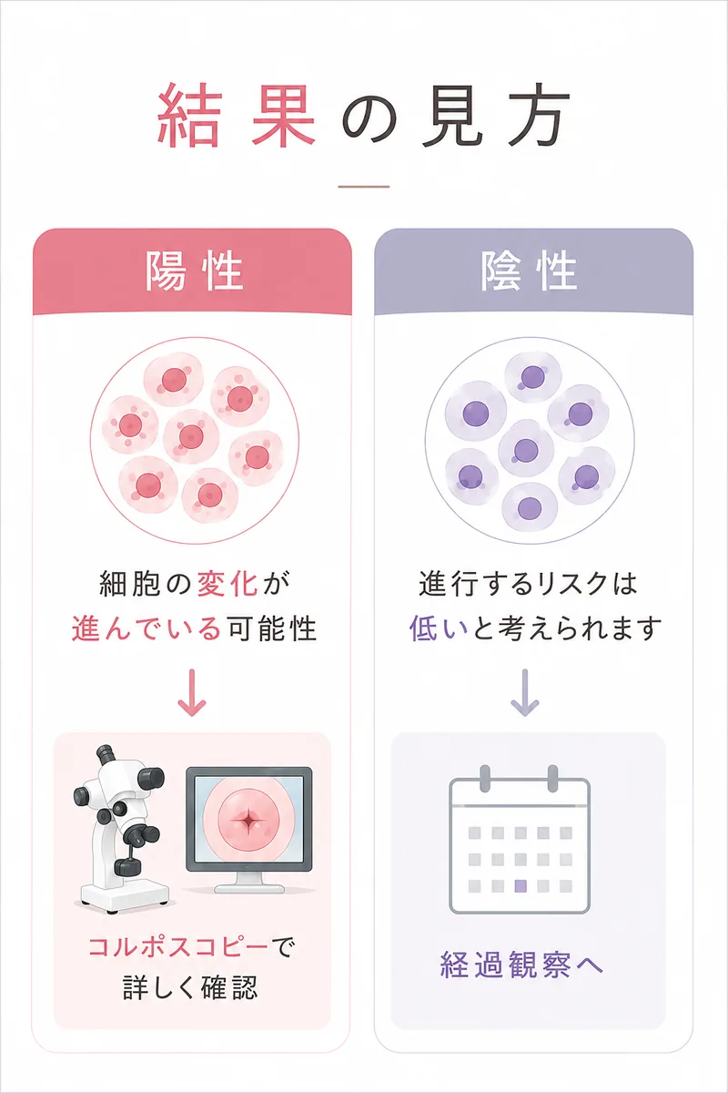 結果の見方 — 陽性：細胞の変化が進んでいる可能性があり、コルポスコピーで詳しく確認します。陰性：進行するリスクは低いと考えられ、経過観察へ進みます。